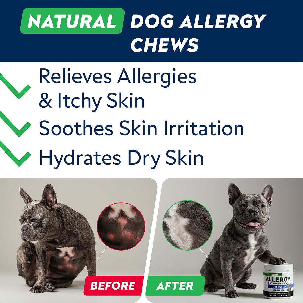 Dog Allergy & Itching Relief - Anti Itch, Skin&Coat Support Chews w/Omega 3